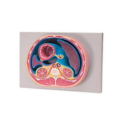 Schematic Cross Section through Abdomen T12