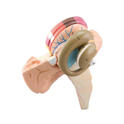 Basal Nuclei & Internal Capsule