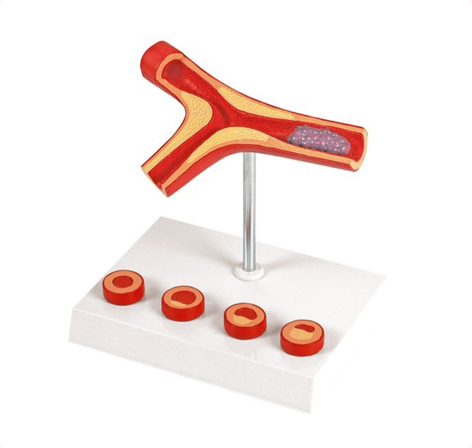 Atherosclerosis and Thrombosis Model