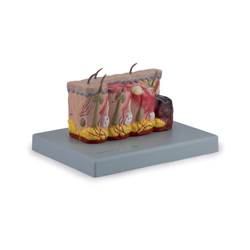 Pathological Model of Burned Skin