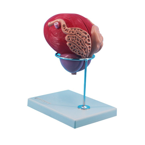 Male Urinary Bladder with Prostate 2 Parts