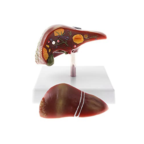 Pathological Model Of The Liver